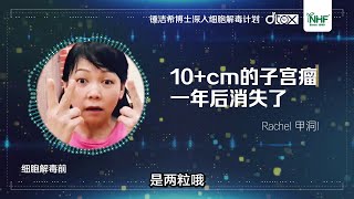 A uterine fibroid over 10 cm in size, migraines for over 30 years, sensitive skin, obesity, and severe asthma.